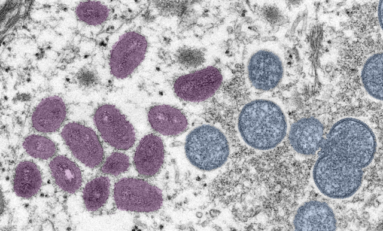 Monkeypox Outbreak Started in the U.K, Researchers Find